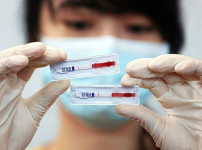 보건부, HIV 퇴치 운동 강화.jpg